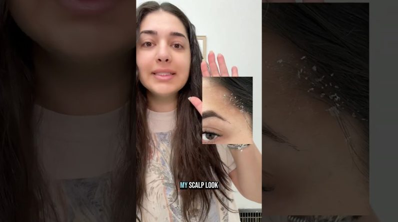 1772642551 maxresdefault