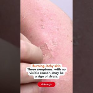 1772700943 maxresdefault