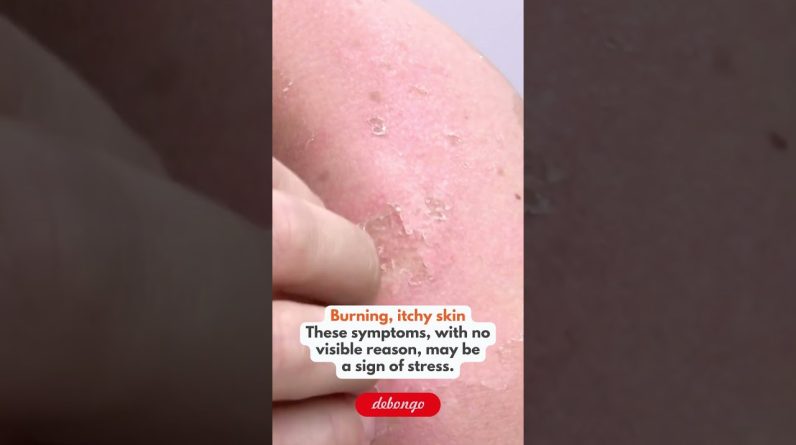 1772700943 maxresdefault