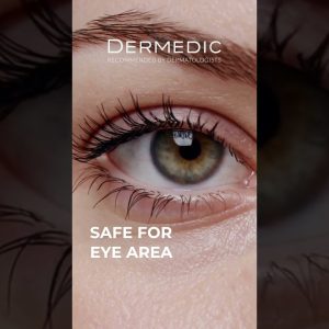 1772701253 maxresdefault