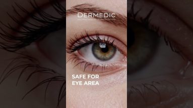 1772701253 maxresdefault