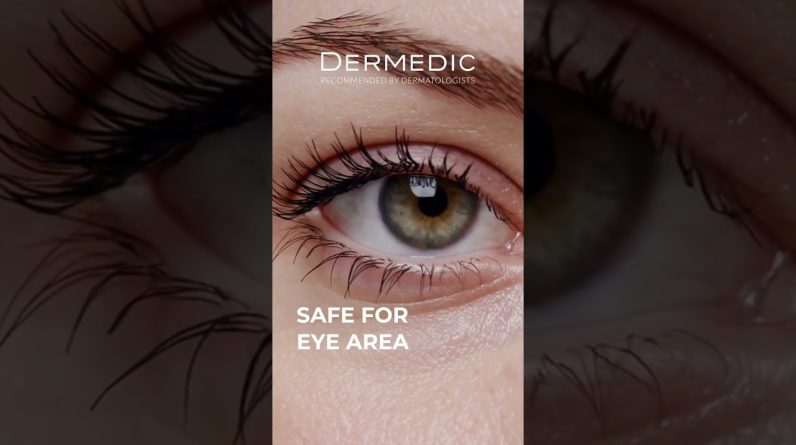 1772701253 maxresdefault