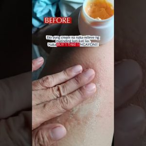 1772708593 maxresdefault