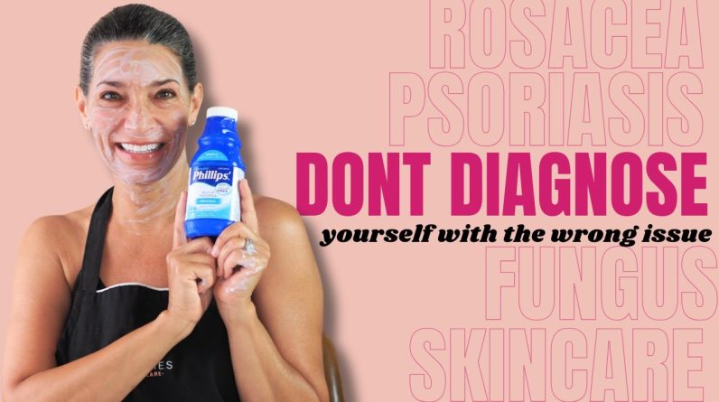 1772712384 maxresdefault