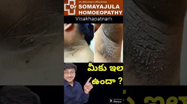 1772785580 maxresdefault