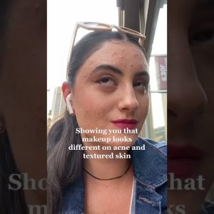 1772788856 maxresdefault