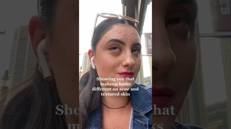 1772788856 maxresdefault