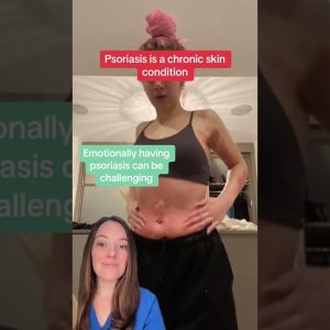 1772799828 maxresdefault