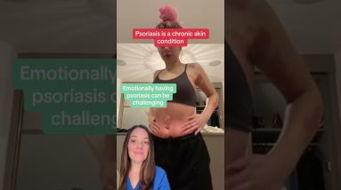 1772799828 maxresdefault