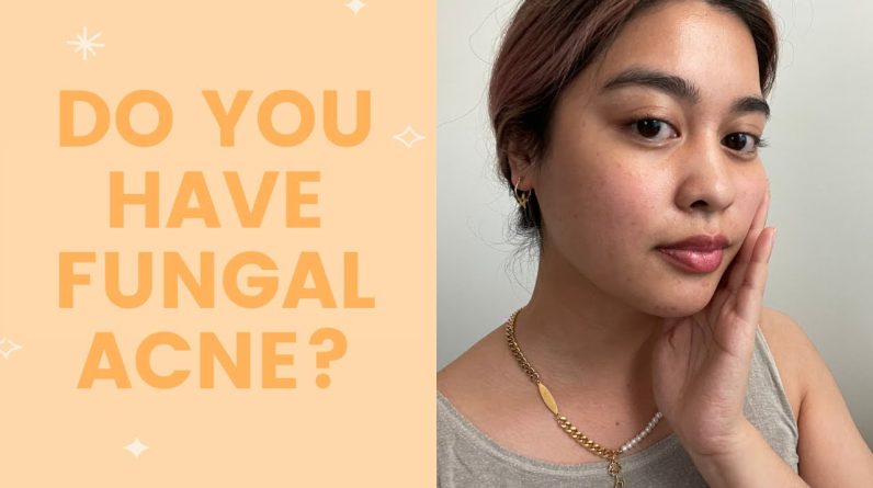 1772888266 maxresdefault