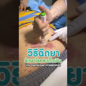 1772891685 maxresdefault