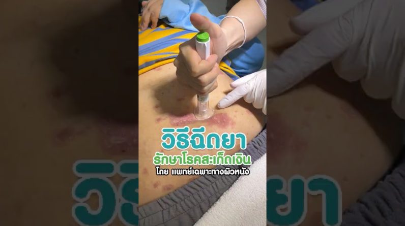 1772891685 maxresdefault