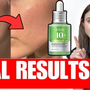 1772895586 maxresdefault