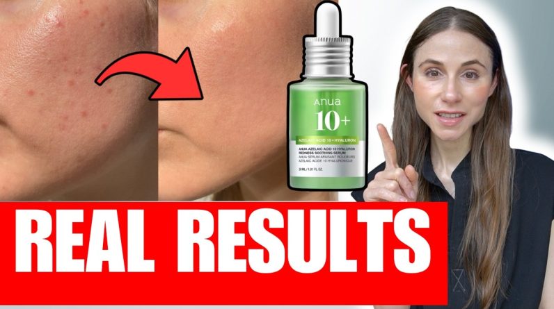 1772895586 maxresdefault